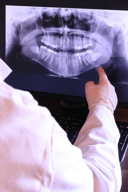 Best Mobile Emergency Dentist in Browns Mills, NJ