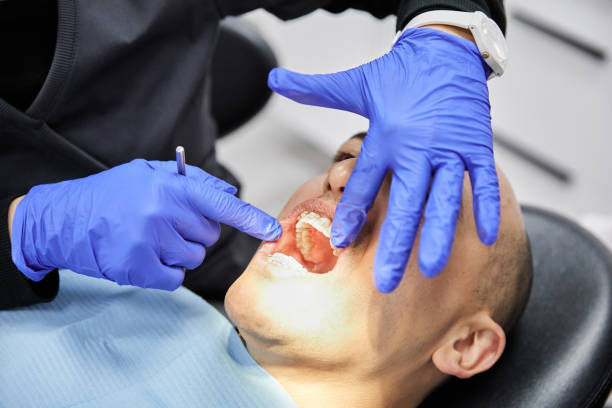 Best Emergency Root Canal Treatment in Browns Mills, NJ